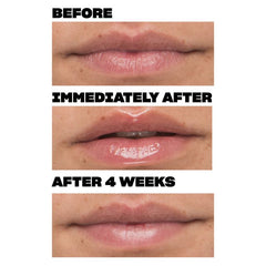 Babe Lash Cloud 9 Lip Serum 0.47oz