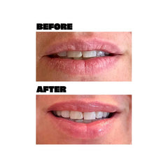 Babe Glow Lip Mask - Black