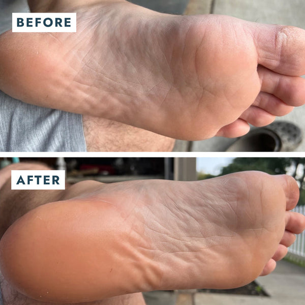 Voesh Solemate Heel Repair Balm 0.74oz