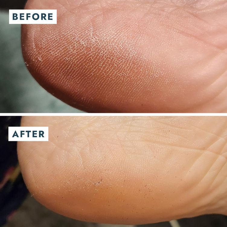 Voesh Solemate Heel Repair Balm 0.74oz