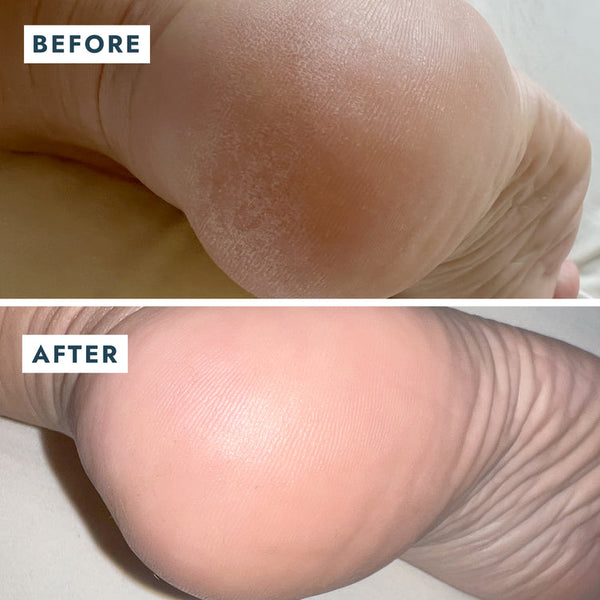 Voesh Solemate Heel Repair Balm 0.74oz