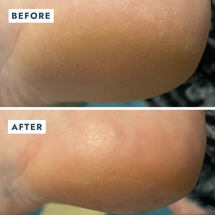 Voesh Solemate Heel Repair Balm 0.74oz
