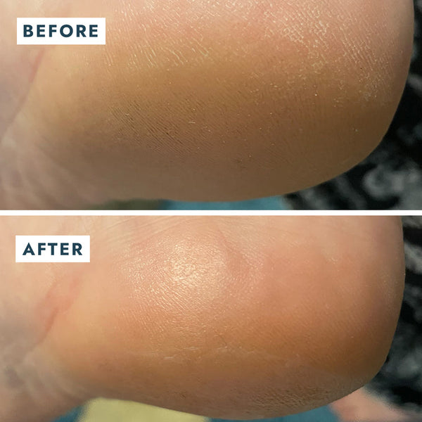 Voesh Solemate Heel Repair Balm 0.74oz