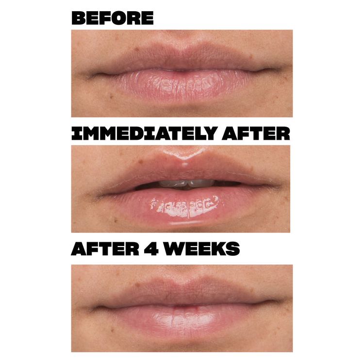 Babe Lash Cloud 9 Lip Serum 0.47oz