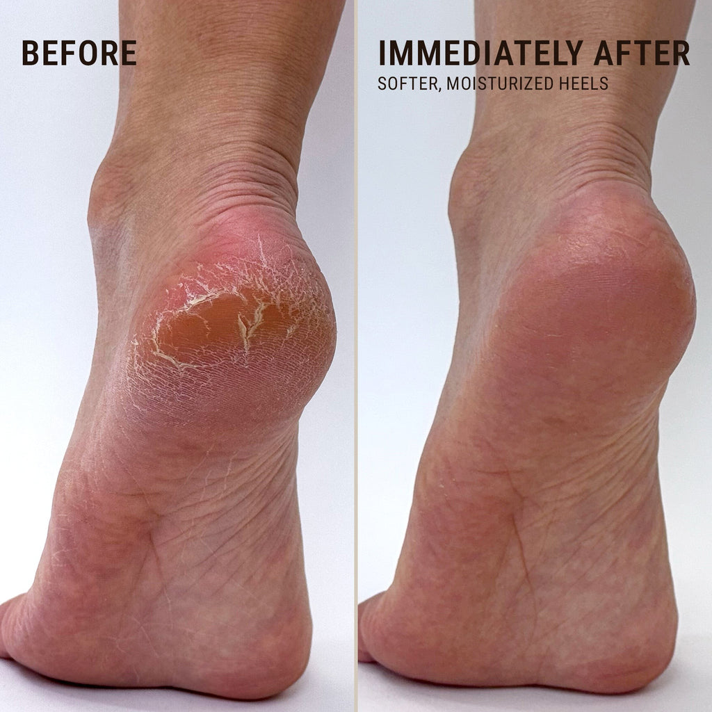 Voesh SoleMate Heel Repair Balm - Lavender